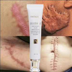 Gel pour la peau efficace à base de plantes FATAZEN
