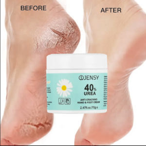 Crème de soin des pieds rougeur