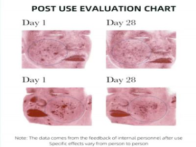 Ensemble de soins de la peau – Image 5